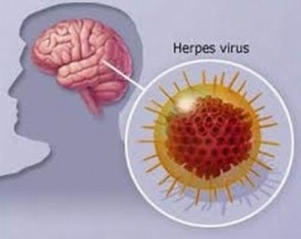 Hỏi - đáp bệnh Viêm não virus và viêm não Nhật Bản